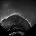 BAG xray microbeam scan